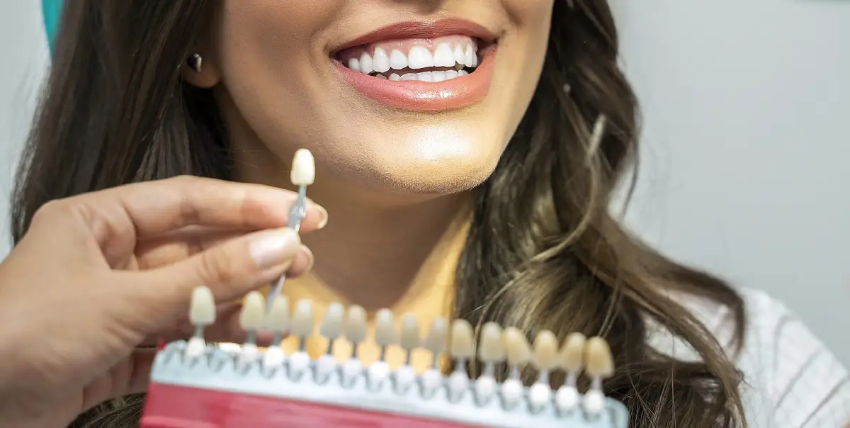 Facetas Dentárias: Transforme seu sorriso | O Guia Completo
